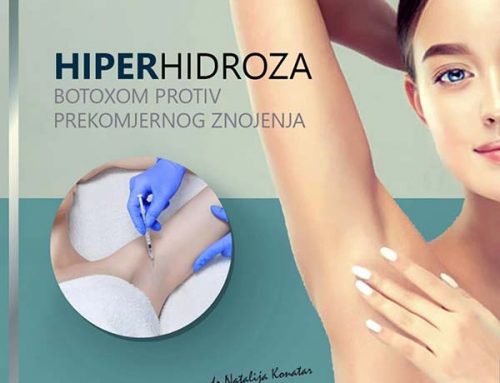 HIPERHIDROZA – BOTOX terapija protiv pojačanog znojenja
