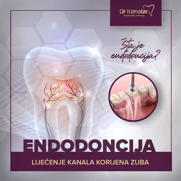 endodoncija