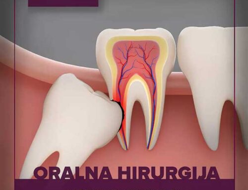 Oralna hirurgija