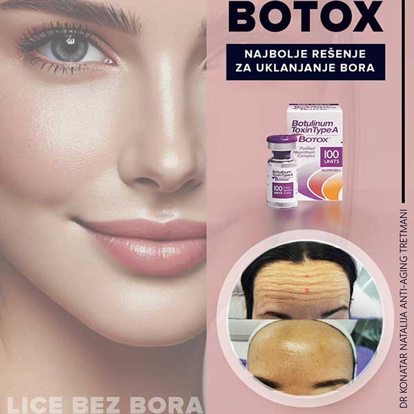 botox2