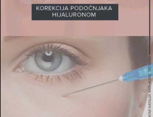 Korekcija podočnjaka hijaluronskim filerima