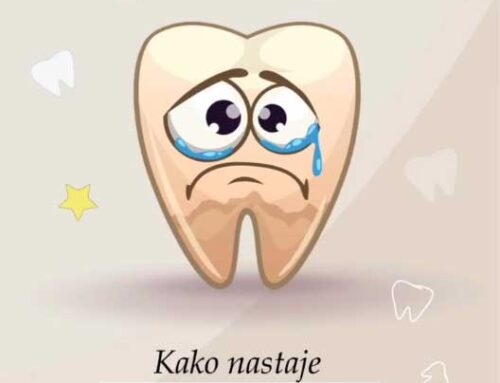 Kako nastaje KARIJES???