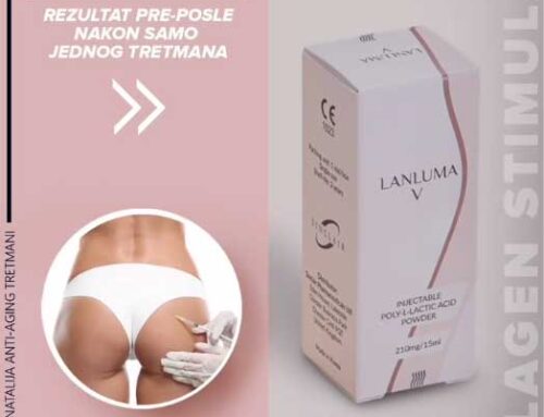 LANLUMA