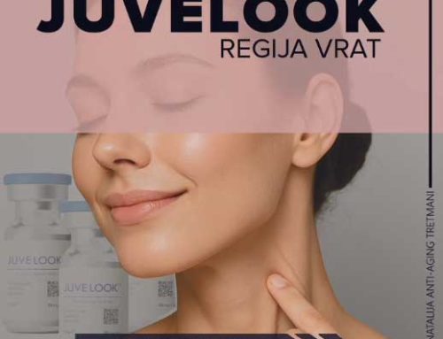 JuveLook – regija vrata