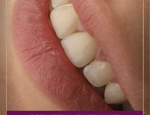 Bezmetalne keramičke krunice