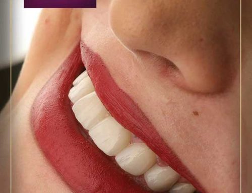 Bezmetalne keramičke krunice