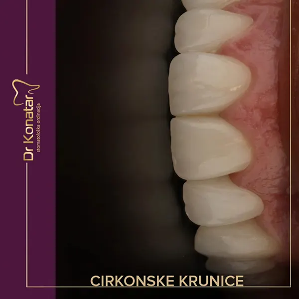 cirkonskeKrunice4
