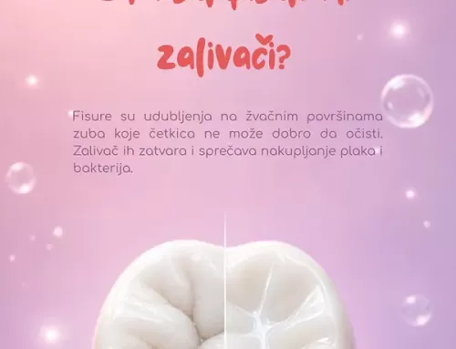 Šta su fisurni zalivači?