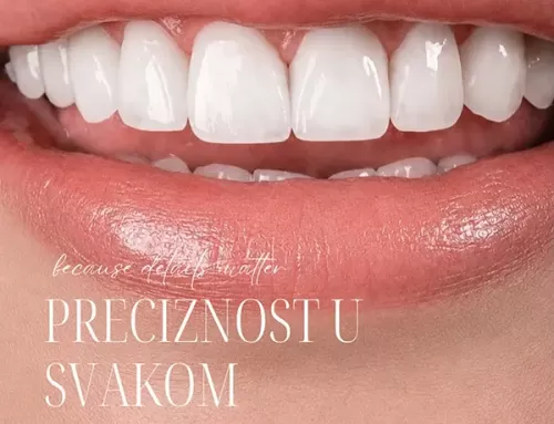 Preciznost u svakom detalju