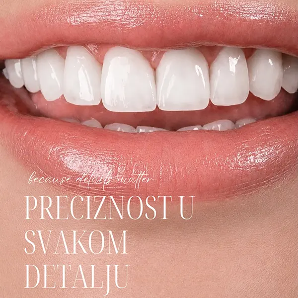 preciznost