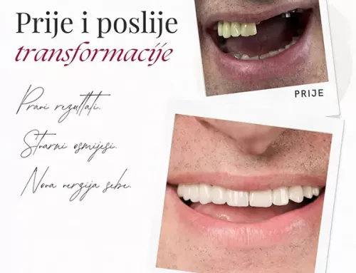 Prije i poslije transformacije