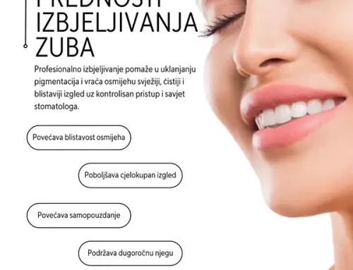 Prednosti izbjeljivanja zuba