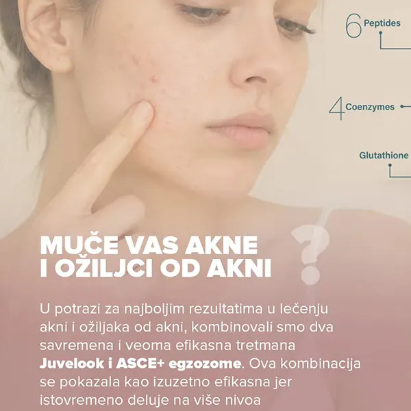 juvelookEgzozomi1