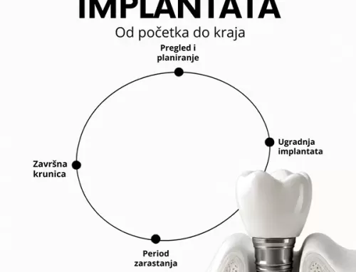 Ugradnja implantata