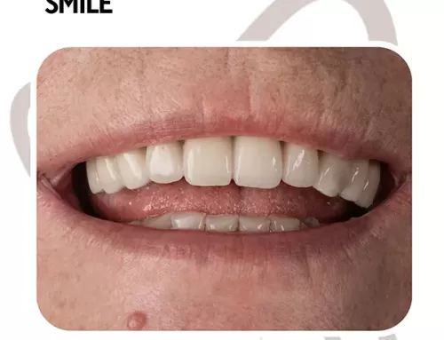 Konatar Smile