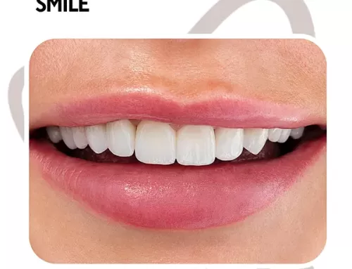 Konatar Smile