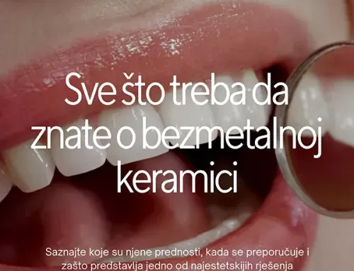 Bezmetalna keramika