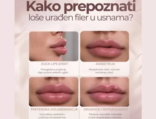 Loše urađen filer u usnama