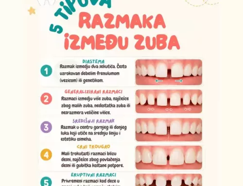 Razmak između zuba